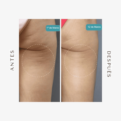 Legging Moldeadora Anticelulitis BelleFit™ 3D – Efecto realza glúteos y abdomen plano
