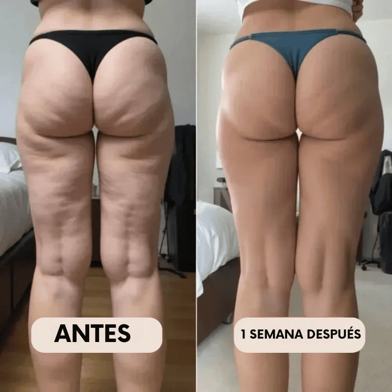 Legging Moldeadora Anticelulitis BelleFit™ 3D – Efecto realza glúteos y abdomen plano