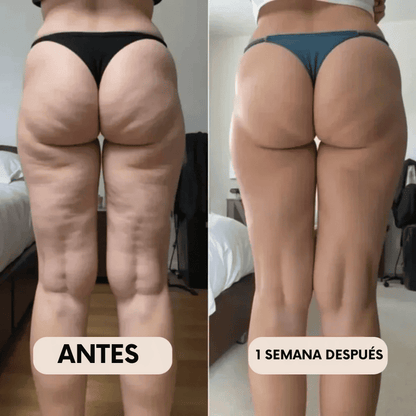 Legging Moldeadora Anticelulitis BelleFit™ 3D – Efecto realza glúteos y abdomen plano