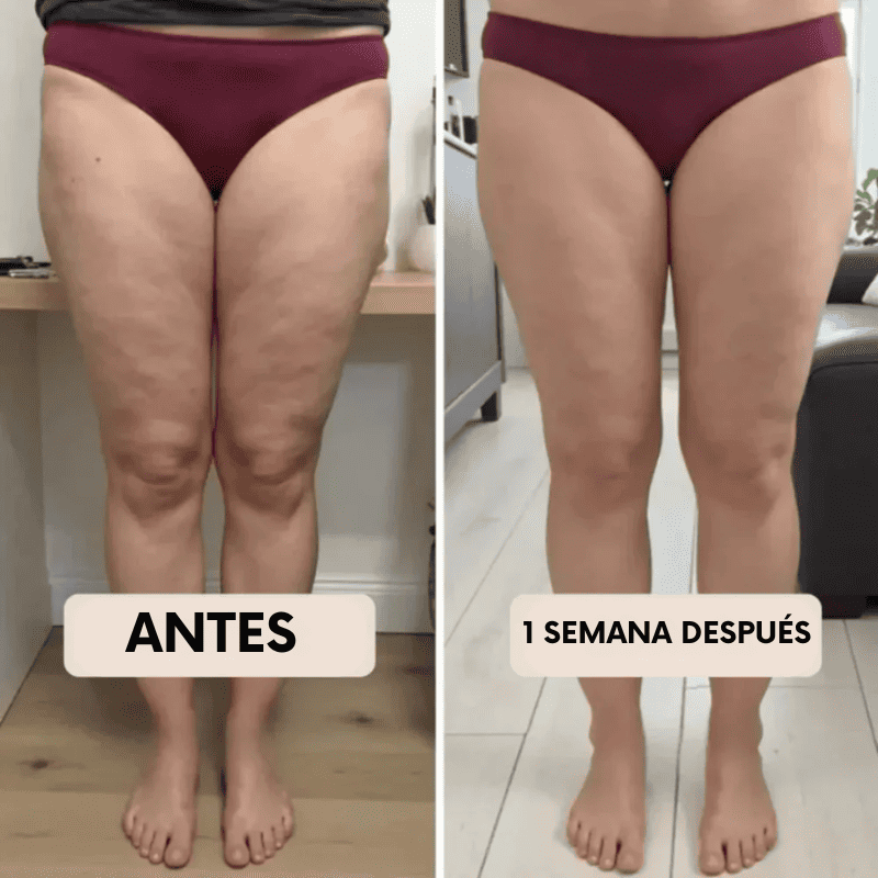 Legging Moldeadora Anticelulitis BelleFit™ 3D – Efecto realza glúteos y abdomen plano