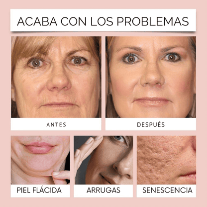 Collagen Skin™ – Mascarilla antiedad con efecto lifting