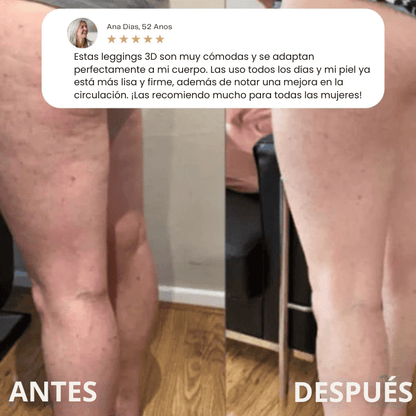 Legging Moldeadora Anticelulitis BelleFit™ 3D – Efecto realza glúteos y abdomen plano
