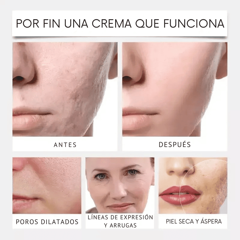 Collagen Skin™ – Mascarilla antiedad con efecto lifting